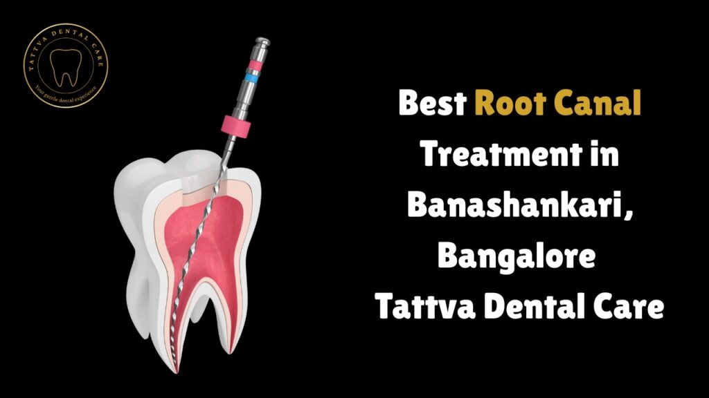 Best Root Canal Treatment in Banashankari, Bangalore – Tattva Dental Care